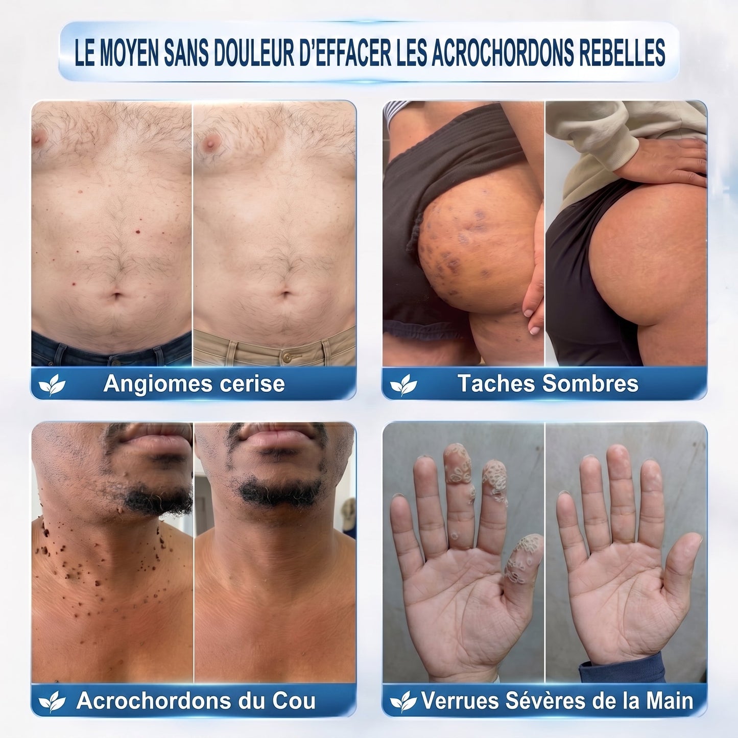 Recommandé par les pharmaciens 👨‍⚕️👨‍⚕️ 𝑯𝗲𝙖𝐥𝒓𝗶𝙯𝗲® 7-Day Tag & Spot Eraser 🪄 (Rollerball sans douleur, sans marques) 👩‍⚕️