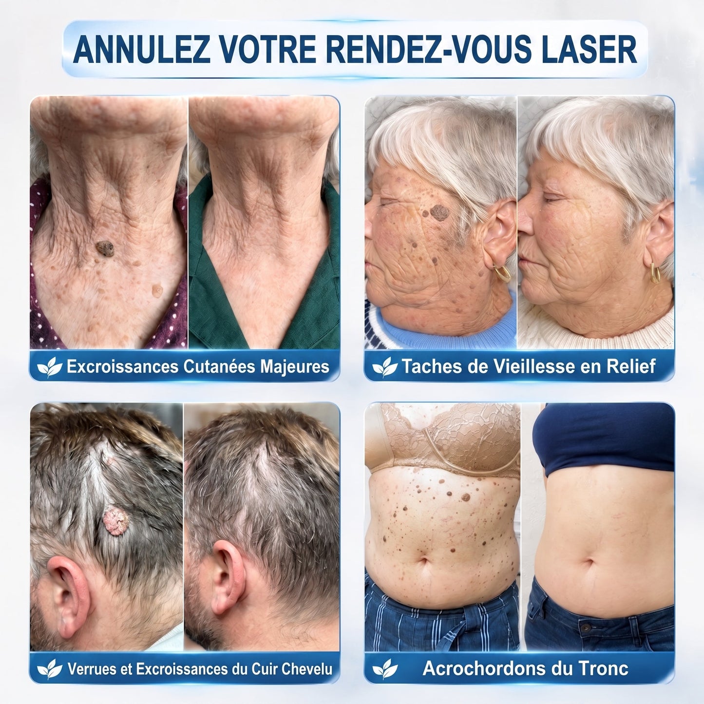 Recommandé par les pharmaciens 👨‍⚕️👨‍⚕️ 𝑯𝗲𝙖𝐥𝒓𝗶𝙯𝗲® 7-Day Tag & Spot Eraser 🪄 (Rollerball sans douleur, sans marques) 👩‍⚕️